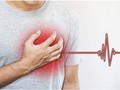 Bệnh nhồi máu cơ tim và đột quỵ thường bị nhầm lẫn, khiến cho việc điều trị, sơ cứu gặp khó khăn.