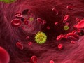 Virus HIV trong máu bệnh nhân.
