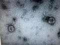 Virus Corona mới đã được nuôi cấy và phân lập thành công. Ảnh: Viện vệ sinh dịch tễ Trung ương 