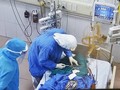 Các bác sĩ tại Khoa Hồi sức tích cực đang chăm sóc cho bệnh nhân 1045 (Ảnh: Văn Phong) 