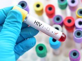 Liệu pháp mới giúp tiêu diệt hoàn toàn virus HIV ở chuột, mở ra hy vọng cho nhân loại