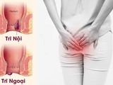 Cảnh báo: Người phụ nữ nhận hậu quả khi dùng thuốc nam chữa trĩ lâu năm