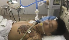 Trần Văn Hiền đang được điều trị tích cực tại Bệnh viện Đà Nẵng