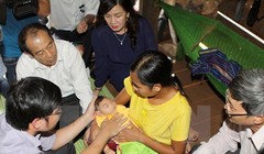 Trẻ có dị tật bẩm sinh mắc chứng đầu nhỏ (Ảnh TTXVN)