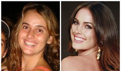 Khủng khiếp việc cắt xương sườn để thi hoa hậu