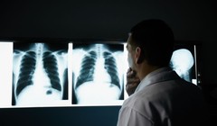 Hình minh họa: iStock/diego_cervo