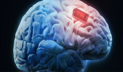 Tăng cường bộ nhớ của những người bị bệnh Alzheimer (Ảnh: Shutterstock)