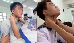 Bác sĩ cảnh báo: Trò “bắt pen” ở giới trẻ cực nguy hiểm, có thể gây tử vong