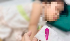 Bé gái 21 tháng tuổi nuốt kẹp tóc vào bụng - cảnh báo tai nạn ở “khối nghỉ hè”