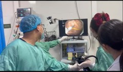 Chiếc tăm 7cm cắm sâu trong dạ dày, bệnh nhân thoát chết trong gang tấc 