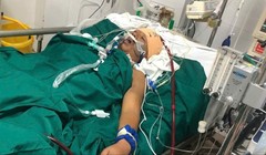 Dập nát ngực, phổi do rơi từ tầng 4, thợ xây vượt cửa tử sau 5 ngày đặt ECMO