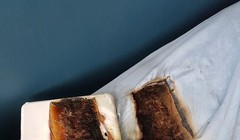 Ảnh hiện trường trên giường của cậu bé.