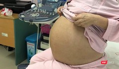 Bệnh nhân M. trước khi phẫu thuật