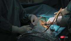 Ê-kíp bác sĩ phẫu thuật do Ths.Bs Nguyễn Văn Lâm – Khoa Ngoại tổng hợp, Bệnh viện đa khoa Đức Giang sử dụng kỹ thuật nội soi để bóc ổ cặn màng phổi nghi do di chứng COVID-19 cho bệnh nhân