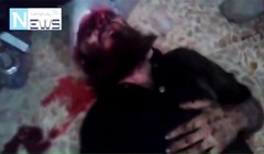 Chiến binh IS bị trọng thương