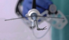 Robot phẫu thuật võng mạc (ảnh minh họa)