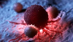 Tấn công tế bào ung thư. Ảnh minh họa