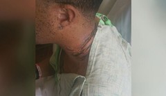 Vết thương điện giật trên người anh Day.