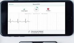 Ảnh: INTERMOUNTAIN MEDICAL CENTRE HEART INSTITUTE / DPA
