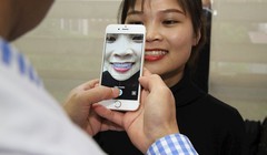 Răng của bệnh nhân được chụp ảnh để chẩn đoán nhờ trí tuệ nhân tạo