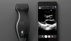 Máy siêu âm kết nối iPhone (ảnh: Phone Arena)