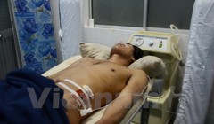 Nạn nhân bị thương được cấp cứu tại Bệnh viện đa khoa tỉnh Đắk Nông- (Ảnh: TTXVN).