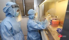 Bệnh nhân 91 phi công người Anh được xét nghiệm COVID-19 hàng ngày để xác định virus SARS-CoV-2 (Ảnh: BYT) 