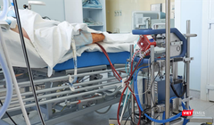 Bệnh nhân 91 phi công người Anh đang phụ thuộc hoàn toàn vào kỹ thuật ECMO (tim phổi nhân tạo) - Ảnh: SYT