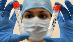 Có hay không “doanh thu khủng” từ việc bán vaccine COVID-19 “đốt cháy giai đoạn” của Nga? (Ảnh: AFP)) 