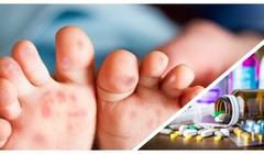 Có thông tin cho rằng thiếu thuốc điều trị bệnh tay chân miệng đang vào mùa cao điểm ở TP.HCM (Ảnh CarePlus, Hòa Bình ghép) 