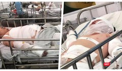 Thương tâm hai bệnh nhi bỏng nặng do cha ruột châm lửa đốt nhà (Ảnh: MT)