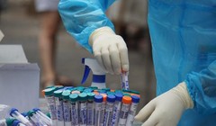 Đẩy nhanh tốc độ xét nghiệm COVID-19 để khoanh vùng dịch bệnh (Ảnh: Báo Chính phủ) 