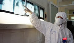 Bác sĩ chuyên khoa điều trị tại Khoa Bệnh Nhiệt đới (Bệnh viện Chợ Rẫy) - Ảnh: BVCR 