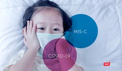 Trẻ em mắc hội chứng MIS-C cần được theo dõi chặt chẽ. Ảnh: HCDC 