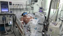 Bệnh nhân sốc sốt xuất huyết nặng điều trị tại Bệnh viện Nhi đồng Thành phố (TP HCM). Ảnh: BVCC