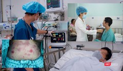 Bệnh nhân cấp cứu vì lạm dụng thực phẩm chức năng. Ảnh: MT