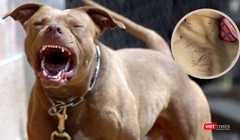 Nhiều vụ chó nhà cắn trẻ gây tổn thương nặng vẫn thường xuyên xảy ra