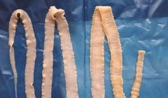 Mẫu sán dây của Viện sốt rét - Ký sinh trùng - Côn trùng TP Hồ Chí Minh