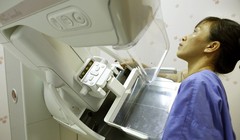 Bệnh nhân chụp Xquang vú tại Bệnh viện Bạch Mai