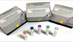 Bộ sinh phẩm mới vừa rẻ vừa chất lượng của nhóm bác sĩ Bệnh viện TWQĐ 108 (Ảnh: Hạnh Nguyên)