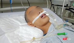Bệnh nhi hôn mê, thở máy, điều trị đã nhiều ngày tại Khoa Truyền nhiễm, Bệnh viện Nhi Trung ương vì mắc bệnh viêm não Nhật Bản