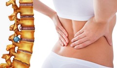 Ảnh minh họa bệnh thoát vị địa đệm cột sống lưng