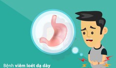 Bệnh viêm loét dạ dày có thể gây nhiều biến chứng nguy hiểm, ví dụ chảy máu dạ dày, ung thư dạ dày ở trẻ nhỏ.