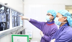 Bác sĩ xem kết quả chụp CT của người đàn ông trước khi thực hiện can thiệp nội mạch.