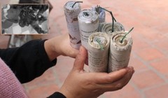 Tự chế pháo nổ, bàn tay của thiếu niên bị chấn thương nặng (Ảnh minh họa).