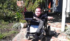 Valery Spiridonov, người tình nguyện tham gia ca phẫu thuật ghép đầu đầu tiên thế giới