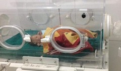 Cháu bé sinh non khi được khoảng 8 tháng và mới chỉ nặng 1,6kg.