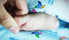 Trẻ từ 15 tuổi trở xuống chiếm phần lớn trong số các tử vong do sốt xuất huyết.