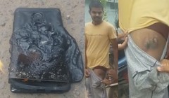 Chiếc RedMi Note 4 đã bốc cháy trong túi một người dùng khi anh ta đang đi xe đạp (ảnh BGR)