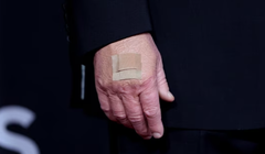 Hình ảnh cận cảnh bàn tay của ông Donald Trump khi ông tạo dáng trên thảm đỏ tại lễ trao giải Kennedy Center Honors năm 2025 ở Trung tâm Biểu diễn Nghệ thuật John F. Kennedy tại Washington, D.C. Ảnh: Reuters.